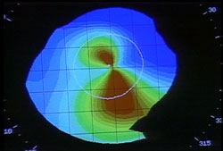CornealMap