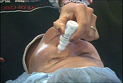 EyeDrops